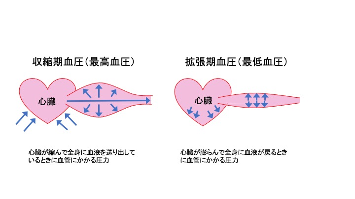 高血圧の診療案内 Mizenクリニック豊洲内科 心療内科